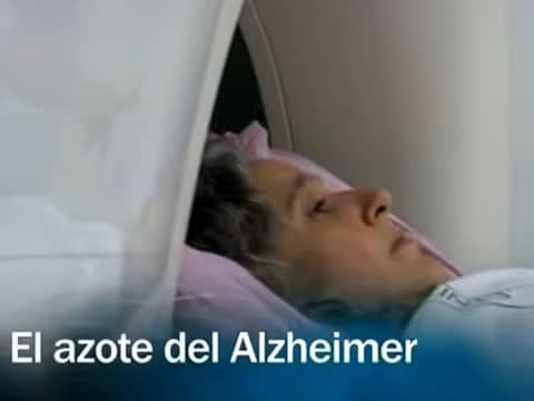 Redes: El Azote Del Alzheimer